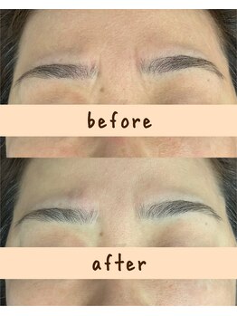 シンシンラボ 豪徳寺(SHINSHIN Lab)/眉間の縦じわが気になる、、、。