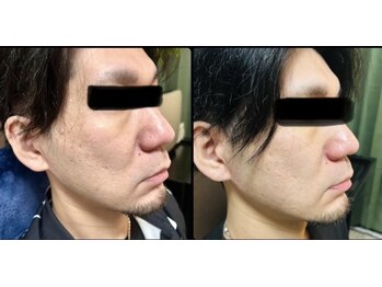 サロンモコ(Salon Moco)/