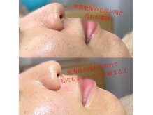 ソワ 吉塚店(soi)の雰囲気（角栓の詰まりは洗顔じゃ落ちません！間違ったケアしていません？）