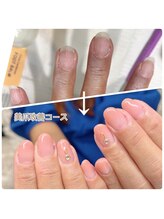 パールズ(PEARLS)/爪が薄いと感じたら【美爪改善】