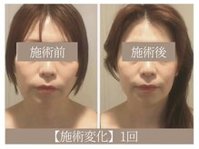 ドクターボディ 恵比寿店(Dr.Body)/【歪み/左右差解消 40代】