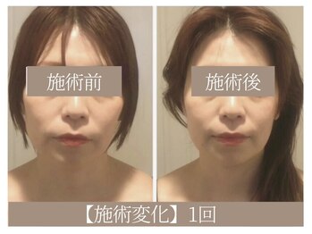 ドクターボディ 恵比寿店(Dr.Body)/【歪み/左右差解消 40代】