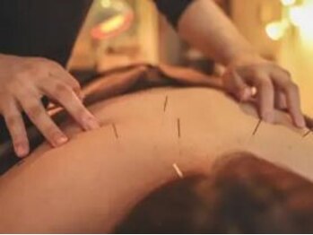 くるみ整骨院鍼灸院の写真/【完全個室】女性鍼灸師在籍!丁寧な施術でお疲れを解消します◎デスクワークや働くママさんも大歓迎◎