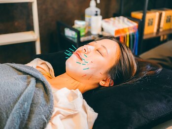 ハリユナイテッド 原宿鍼灸 整体院(HALI UNITED)/美容鍼