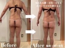 ディオネの雰囲気（くびれ、大転子の出っ張り改善、ヒップUP効果◎）