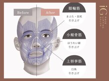 アイジー(iG)の雰囲気(筋肉を専門的に知り高いフェイスリフティング技術をご提供します)