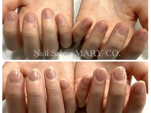 マリーシーオー(MARY-CO.)の雰囲気（深爪矯正/2ヶ月経過(ホームケアでオイル1本使用)）