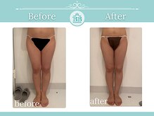 美人バスト 辻堂店/バストを残してダイエット症例