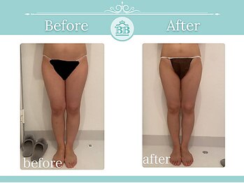 美人バスト 辻堂店/バストを残してダイエット症例
