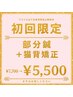 【初回限定】部分鍼+猫背矯正 7,700円→5,500円