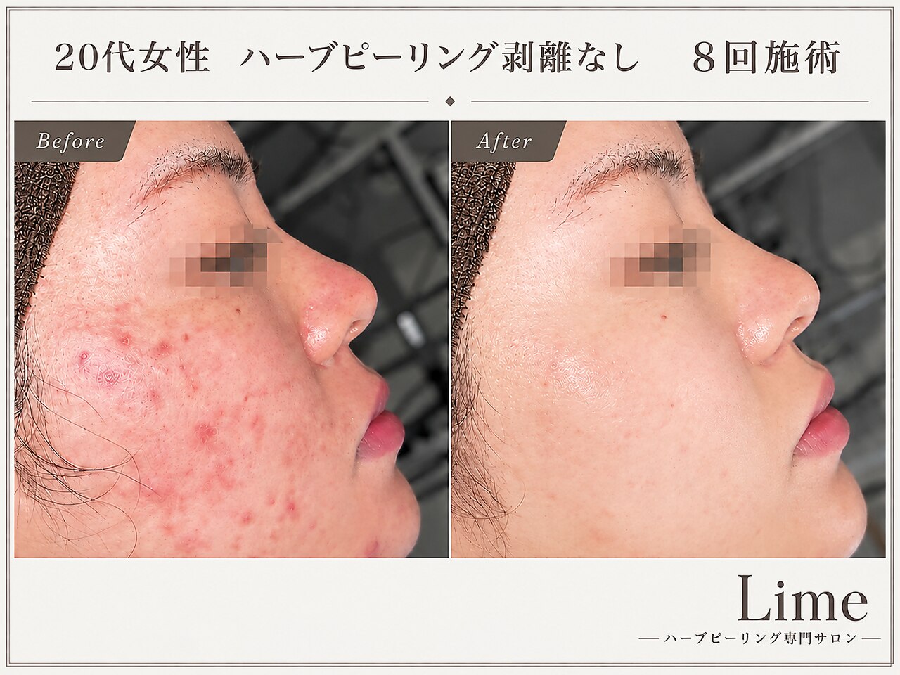 ライム 錦糸町(LIME)｜ホットペッパービューティー