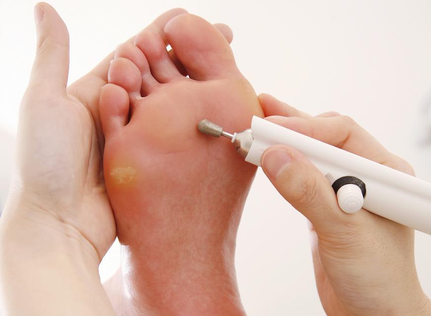 C005981887.jpg?impolicy=