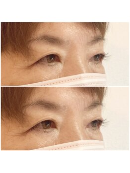 ミント アイラッシュ(mint)/フラットマットラッシュ