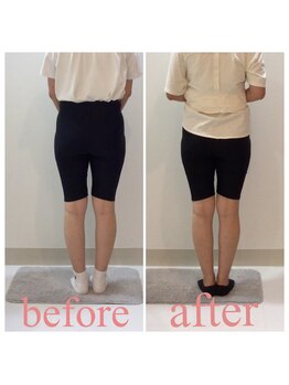 スタイルラボ高松/産後の骨盤矯正の効果♪