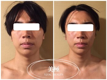 美極 トータルビューティー(美極 TOTAL BEAUTY)/恵比寿/小顔コルギ/エステ