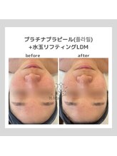 ポムハヌル 大阪梅田中崎町(pom.haneul)/韓国肌管理室