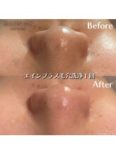 サロン ド エス アオヤマ(SALON DE S AOYAMA)/毛穴徹底ケアで毛穴レス肌に！