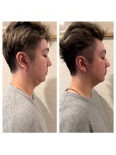 ビューティースタジオ韓美 新宿御苑前/ヌべリス/マイクロウェーブ小顔