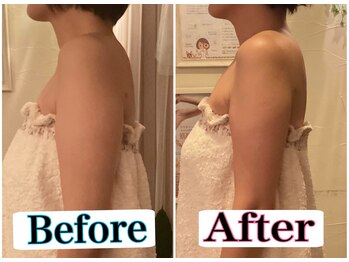 トータルビューティーサロン 凛/二の腕ほっそり