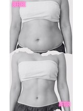 ヨサパーク ゴールデンツリー 浦安本店(YOSA PARK GordenTree)/見せる★お腹