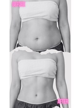 ヨサパーク ゴールデンツリー 浦安本店(YOSA PARK GordenTree)/見せる★お腹