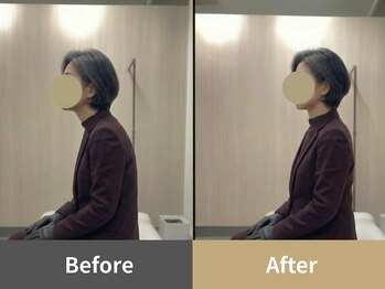 整体クオーレ 奈良新大宮店(Cuore)/Before After