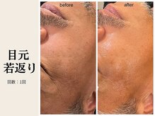 サロン ルイス アディクト(salon Lewis Addict)/ハイアールエフウェーブ