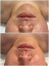 サロンドシェリ(salon de cheri)/脱毛＆フェイシャル