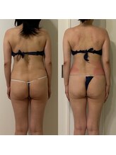 ミヨン(Miyong)/生活変わらず維持しています！