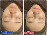 【Ｃ】小顔+たまご肌へ♪美肌パックコース