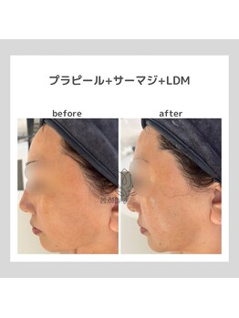 ポムハヌル 大阪梅田中崎町(pom.haneul)/韓国肌管理室