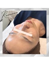 リモア(REMORE)/《お客様》エンビロン肌質改善