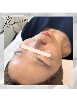 リモア(REMORE)/《お客様》エンビロン肌質改善