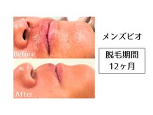 メンズビオ 神戸三宮店/