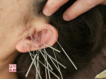 はりきゅう和 ルート鍼灸院/イヤホン疲れ、インカム疲れ