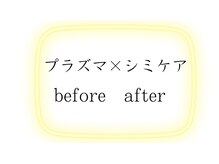 ラビエス(LAVIES)/結果重視プラズマ/シミケア
