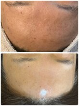 サロン エム(Salon M)/毎月コツコツ。ダクトピール