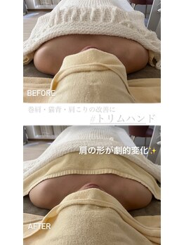 ルルボーテ(Loulou Beaute)の写真/【とにかく頑固な肩こりに】肩こり・巻肩改善に特化したメニュー「トリムハンド」で肩の重さを撃退!