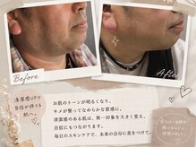 ケイ エムワン(K M1)の雰囲気(お顔のトーンもアップ◎清潔感アップ!自信が持てる肌へ!)