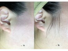 エンジェルワックス 蒲田店(Angel Wax)/【もみあげWワックス】