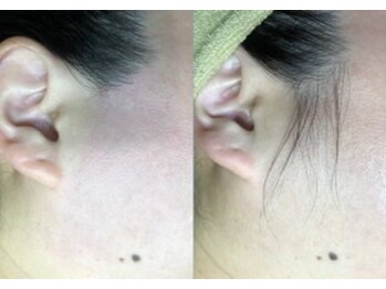 エンジェルワックス 蒲田店(Angel Wax)/【もみあげWワックス】