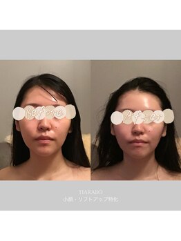 ティアラボ(TIARABO)/