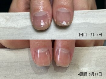 自爪育成３ヵ月コース