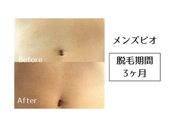 メンズビオ 神戸三宮店/