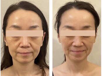 ドクターボディクリスタル(Dr.Body Crystal)/50代