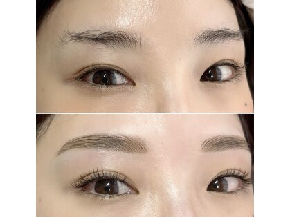 アイリス(EYELISS)の写真