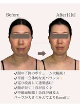 アンジェリカ(Angelica)/本来の美バランス/顔の長さ/小顔