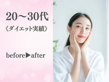 整体院カイト/20~30代/ビフォーアフター