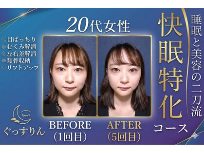 ぐっすりんの写真