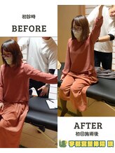 宇都宮整体院 咲/ビフォーアフター